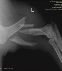 오삼이 왼쪽 앞다리 사고당시 엑스레이 사진