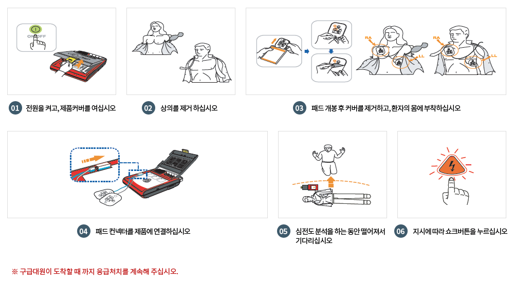 1. 전원을 켜고, 제품커버를 여십시오, 2. 상의를 제거 하십시오, 3. 패드 개봉 후 커버를 제거하고, 환자의 몸에 부착하십시오, 4. 패드 컨텍터를 제품에 연결하십시오, 5. 심전도 분석을 하는 동안 떨어져서 기다리십시오, 6. 지시에 따라 쇼크버튼을 누르십시오, ※구급되원이 도착할 때 까지 응급처치를 계속해 주십시오.